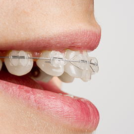 日進市米野木・こめのき台加藤歯科