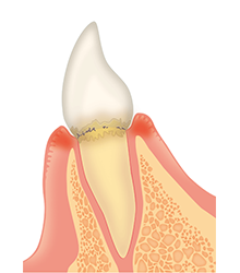 日進市米野木・こめのき台加藤歯科