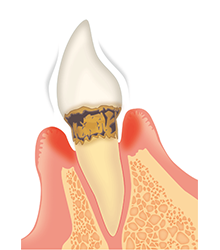 日進市米野木・こめのき台加藤歯科